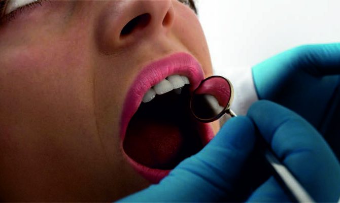 Cigarrillo, alcohol y sexo oral, factores de riesgo para tumores que pueden detectarse con abrir la boca
